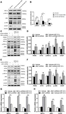 Inhibition of the IRE1/JNK pathway in renal tubular epithelial cells attenuates ferroptosis in acute kidney injury